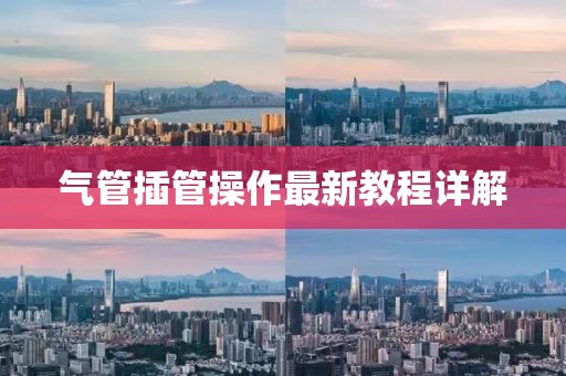 氣管插管操作最新教程詳解
